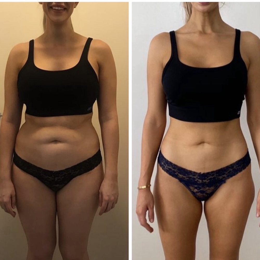 Client transformation, front